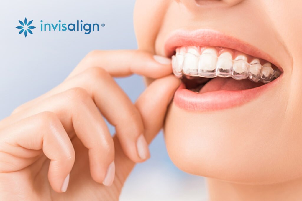 Dr-Naiks-Dental-Studio-invisalign