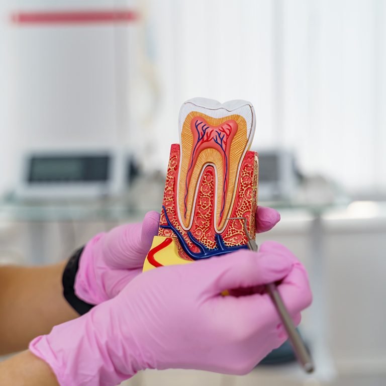 Dr-Naiks-Dental-Studio-root-cannal